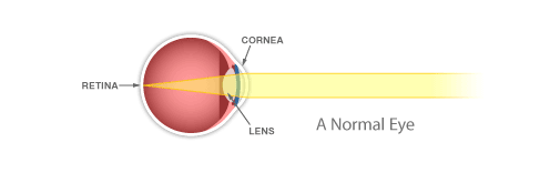 Cornea care